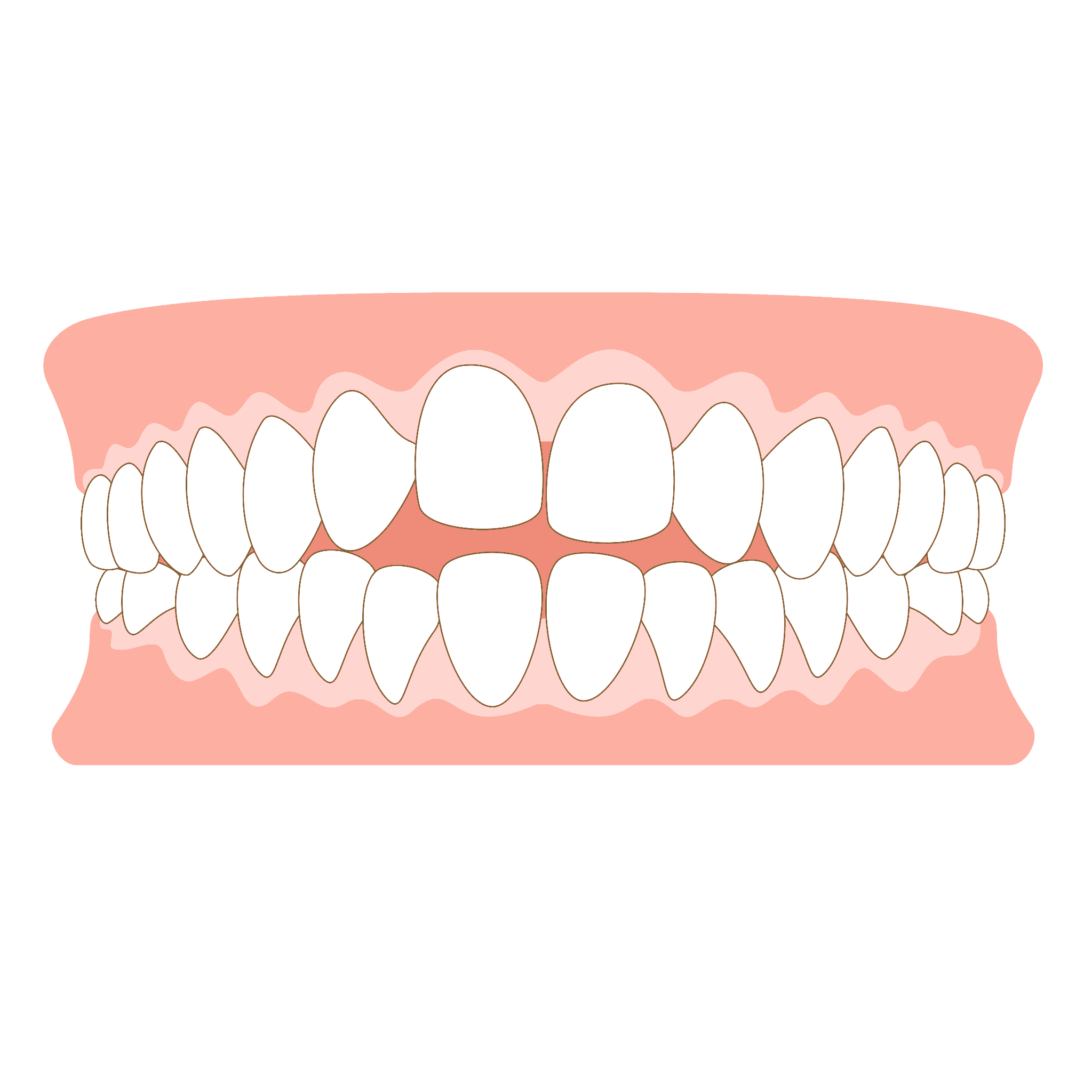 オープンバイトのイラスト