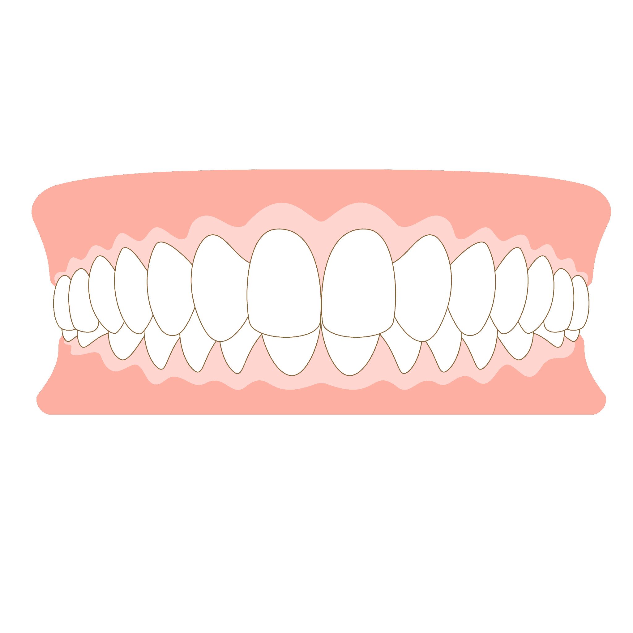 ディープバイトのイラスト