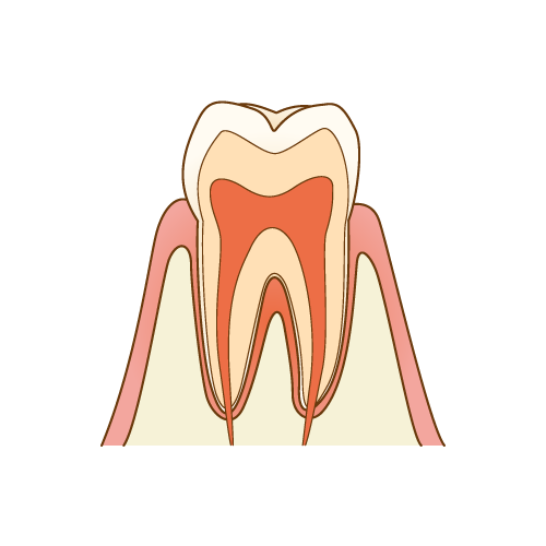 歯の神経