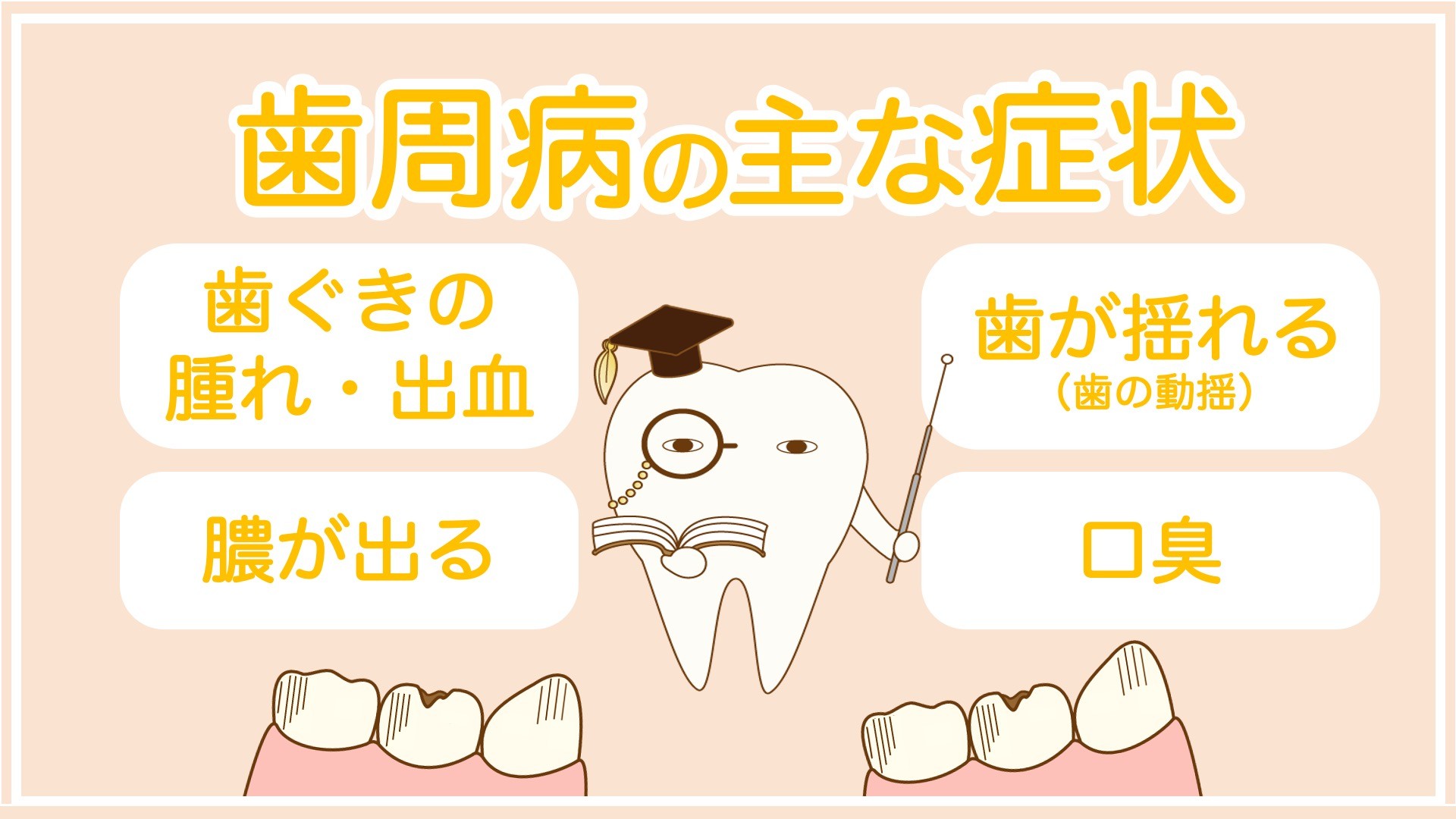 歯周病の代表的な症状：歯ぐきの腫れ・出血