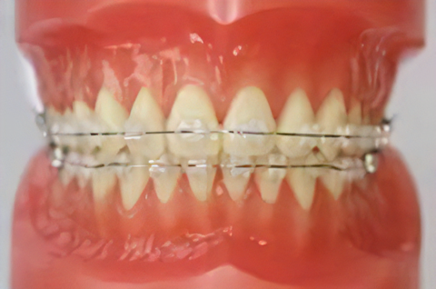 目立ちにくい組み合わせも可能です