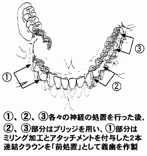 様々な治療方法を検討し、患者様にとって最善の治療を提供します。