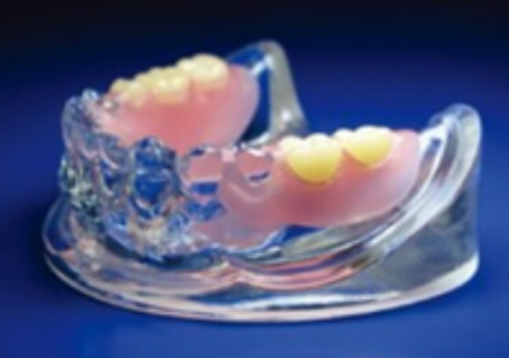 審美性と装着性を重視した設計された総入れ歯