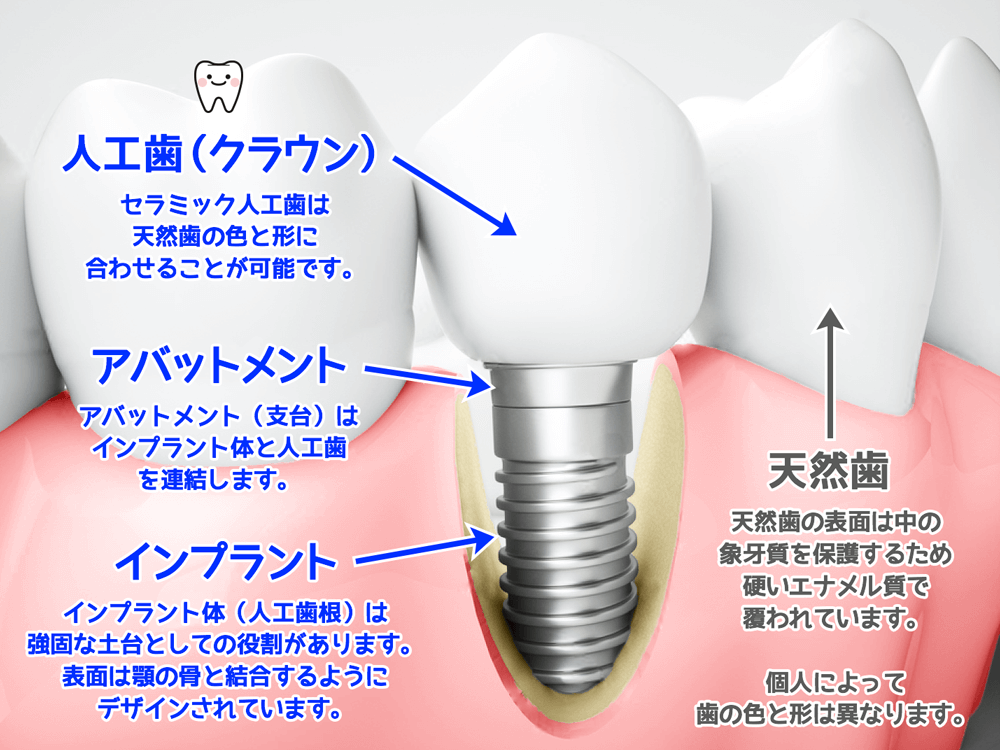 精度の高い診断と技術で、天然歯のような快適な生活をサポートします