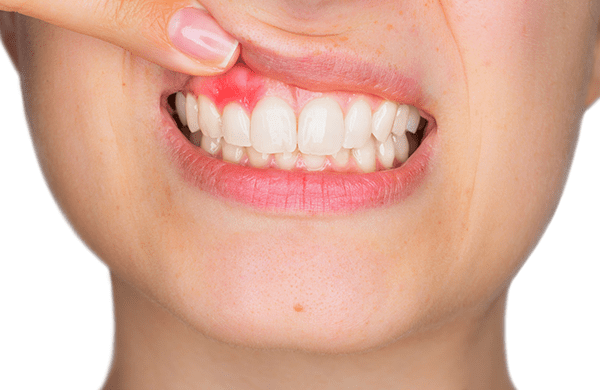 早めの受診をおすすめします