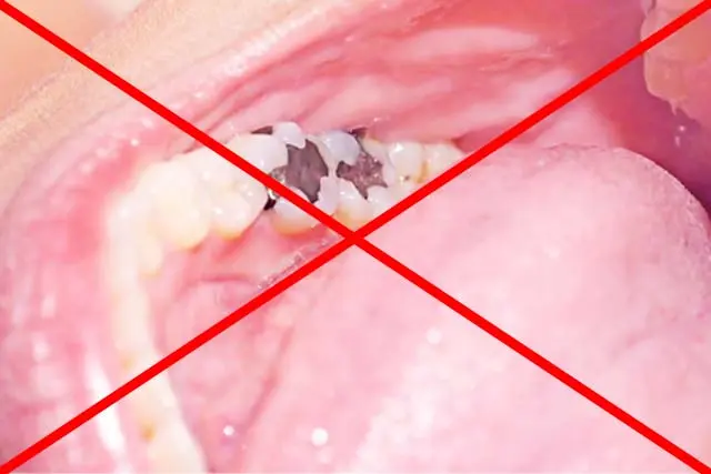 パラジウムフリーを推奨し、患者様の健康に配慮した治療を提供