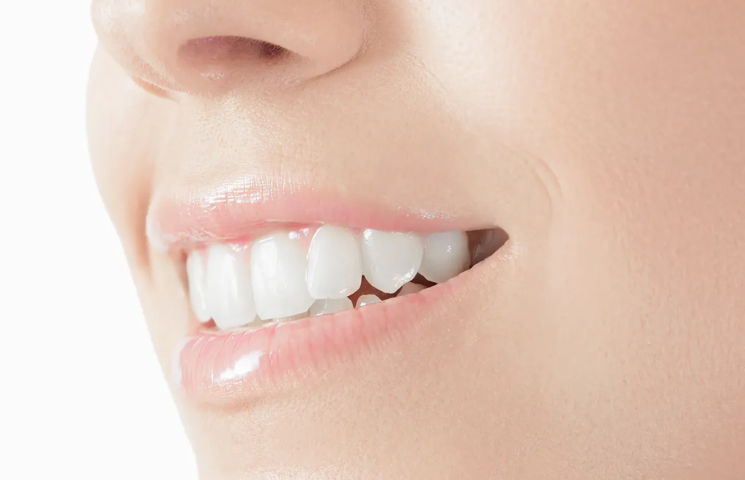 鏡の中の笑顔が変わる、セラミックの選択