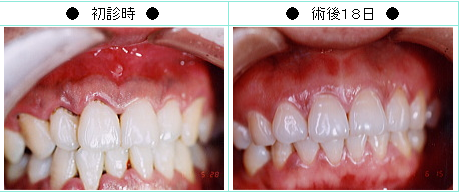 適切な治療を行なうことで短期間で改善が可能です