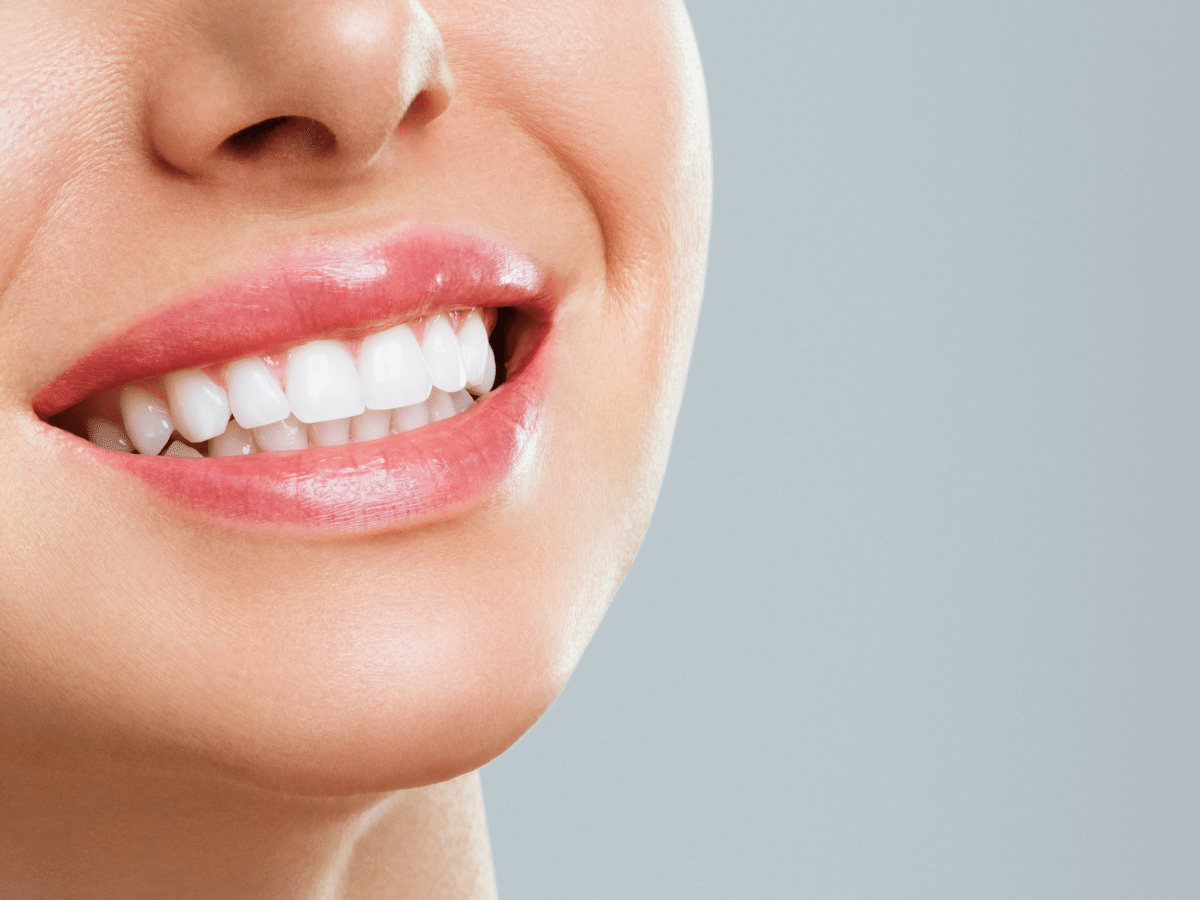 歯を白くしたい