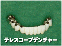 装着時の自然さに配慮した入れ歯を提案