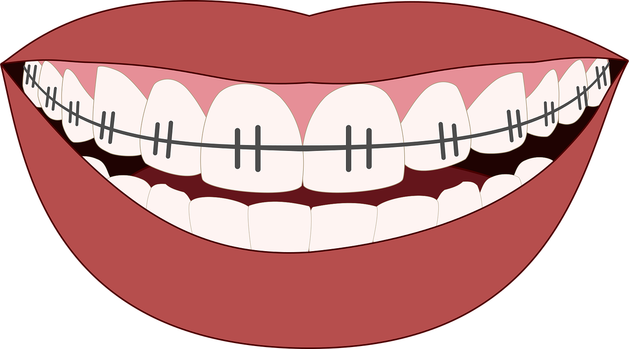 美しい歯並びと健康的な咬み合わせをサポートいたします。※写真はイメージです。