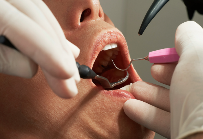 歯の色が変われば、人生の輪郭も変わる