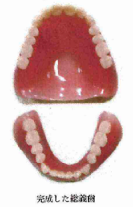 患者様の症状やご希望に合わせた補綴物をご提案いたします