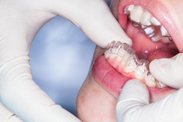 ※画像はイメージです