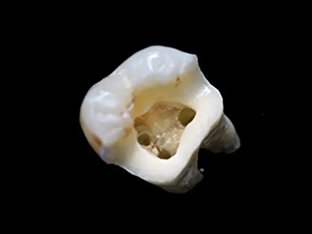 肉眼の20倍まで拡大できるマイクロスコープにより、根管の細部を確認しながら精密な治療を実施