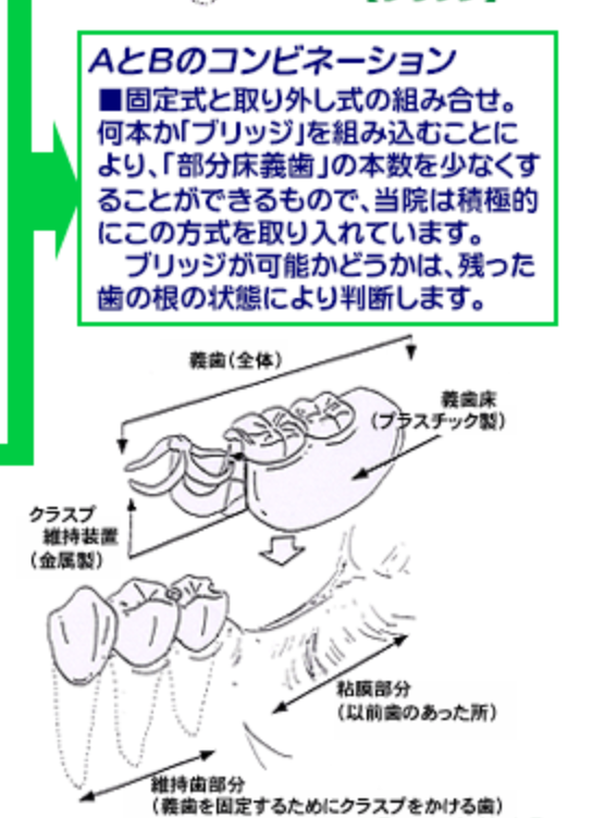 患者様の口腔状態に合った処置をご提案します