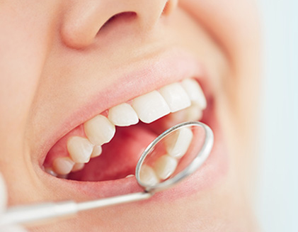 痛みの少ない治療を心がけています