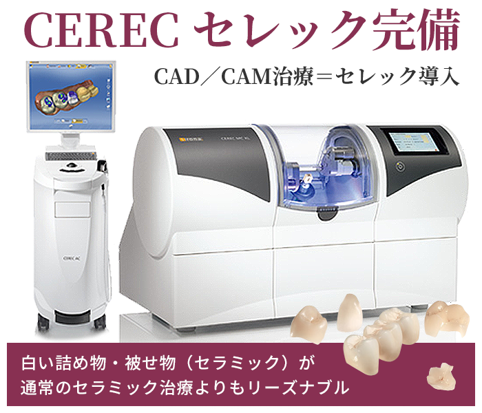 いそだ歯科クリニックが提供するセレック治療の特徴とメリット