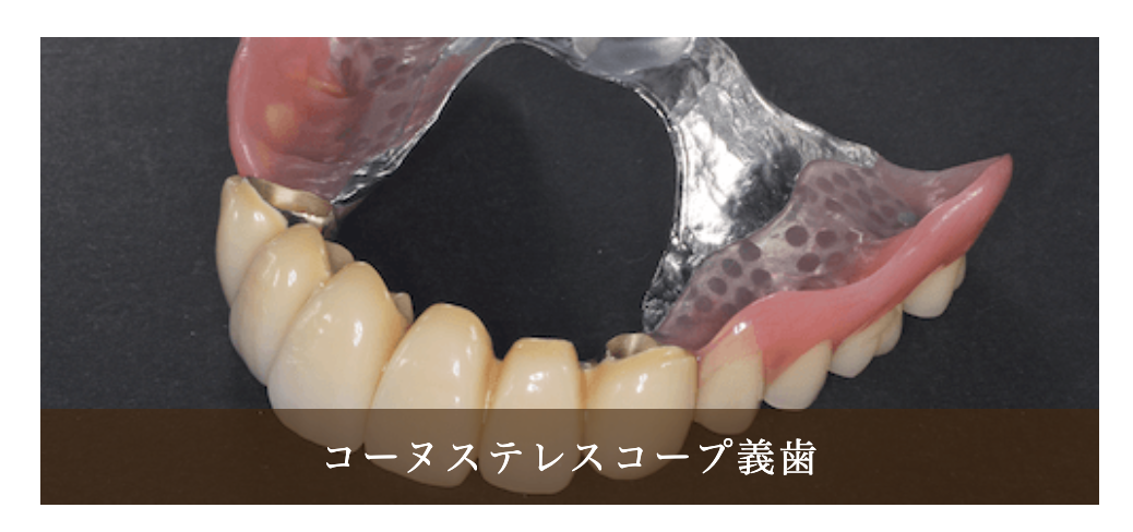 義歯(入れ歯)治療を通じて、しっかりと噛める快適な口腔環境を提供しています