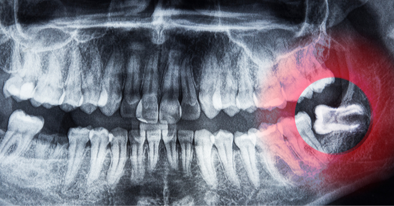 専門医による口腔外科治療で安心・的確な対応を提供します