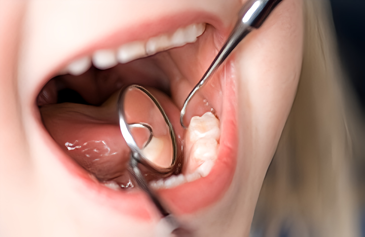 歯ぐきの小さな違和感を見逃さない診療