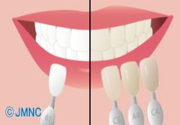 白い歯で笑顔に自信が持てます