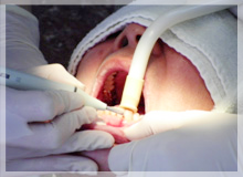 専門的な清掃とブラッシング指導で再発防止をサポート