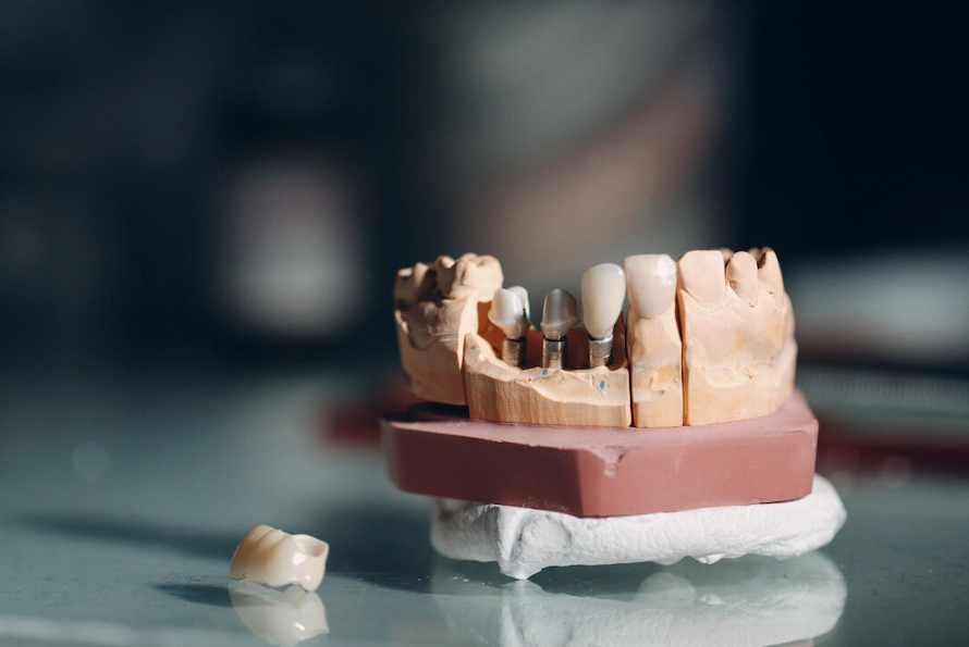 30年以上の実績と3つの専門医資格による精密診断で安心のインプラント治療