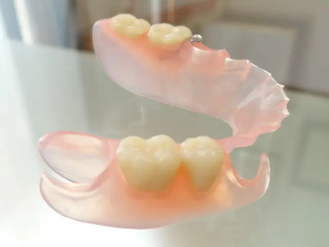 金属のバネがなく目立たないノンクラスプデンチャーを提供します