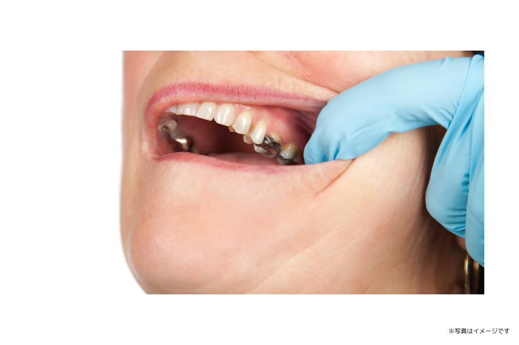 ※写真はイメージです