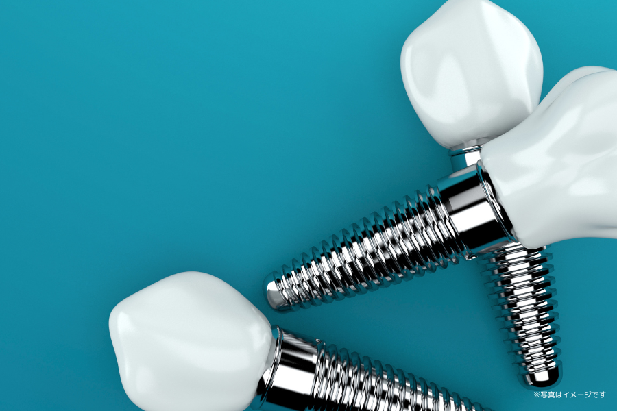 ※画像はイメージです