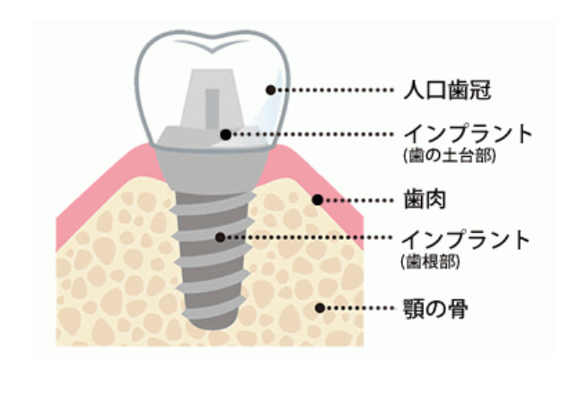 最新技術を取り入れて患者様の安全性と快適さを重視し、より自然で機能的な歯を提供しています。