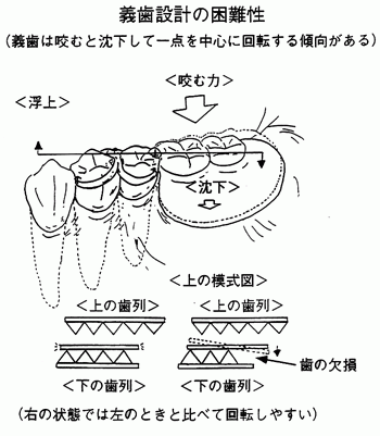 良い義歯を作製するポイントは、歯の機能の把握と筋肉の動きを制御する設計を行うことです