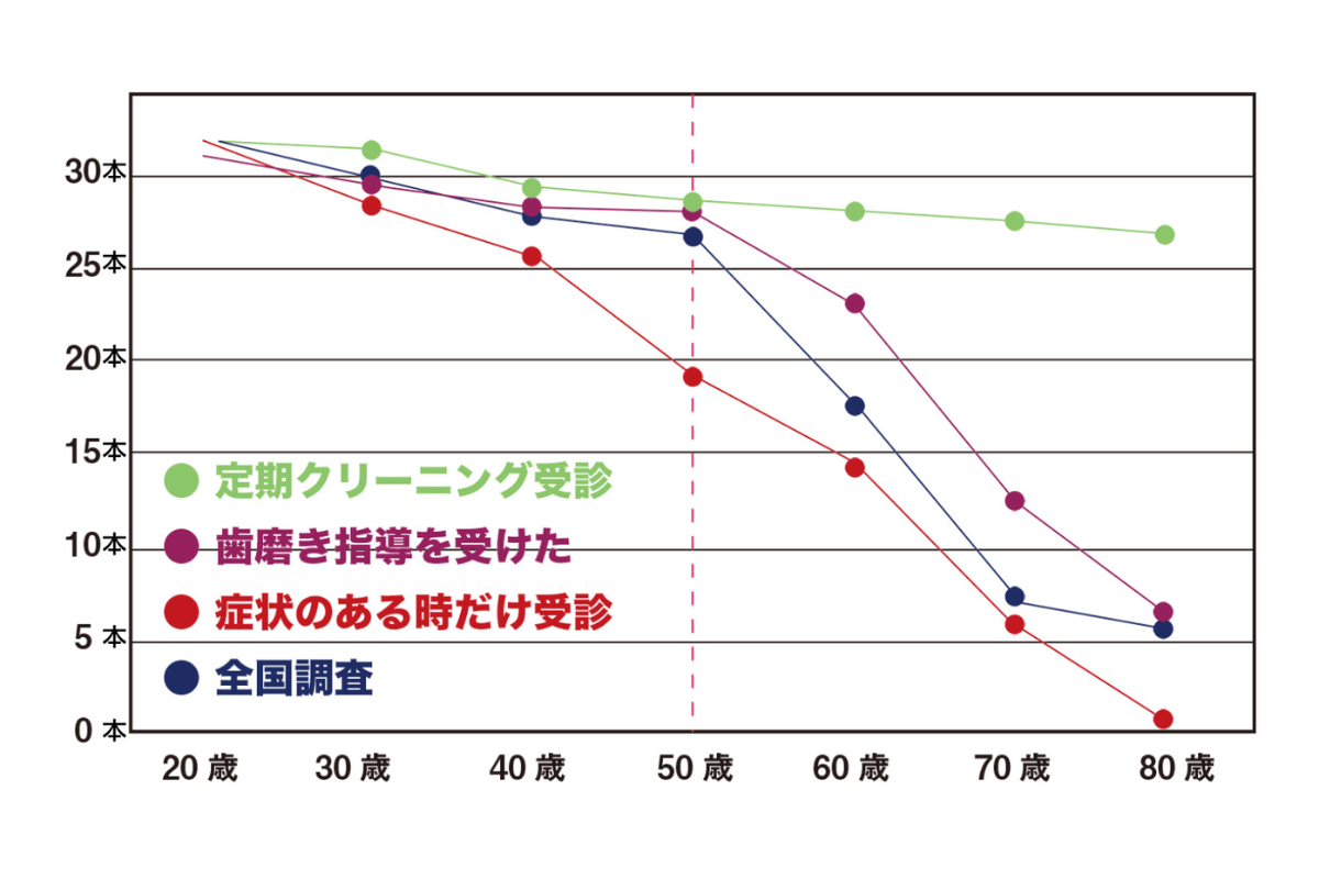 予防歯科-一生モノの笑顔のために!10代から始める賢い歯の守り方