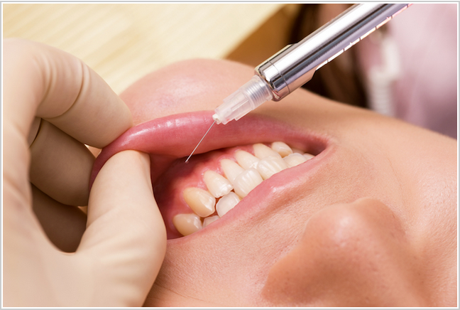 痛みや負担を軽減する虫歯治療