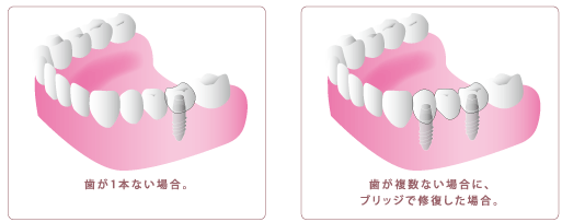 様々な治療法があります