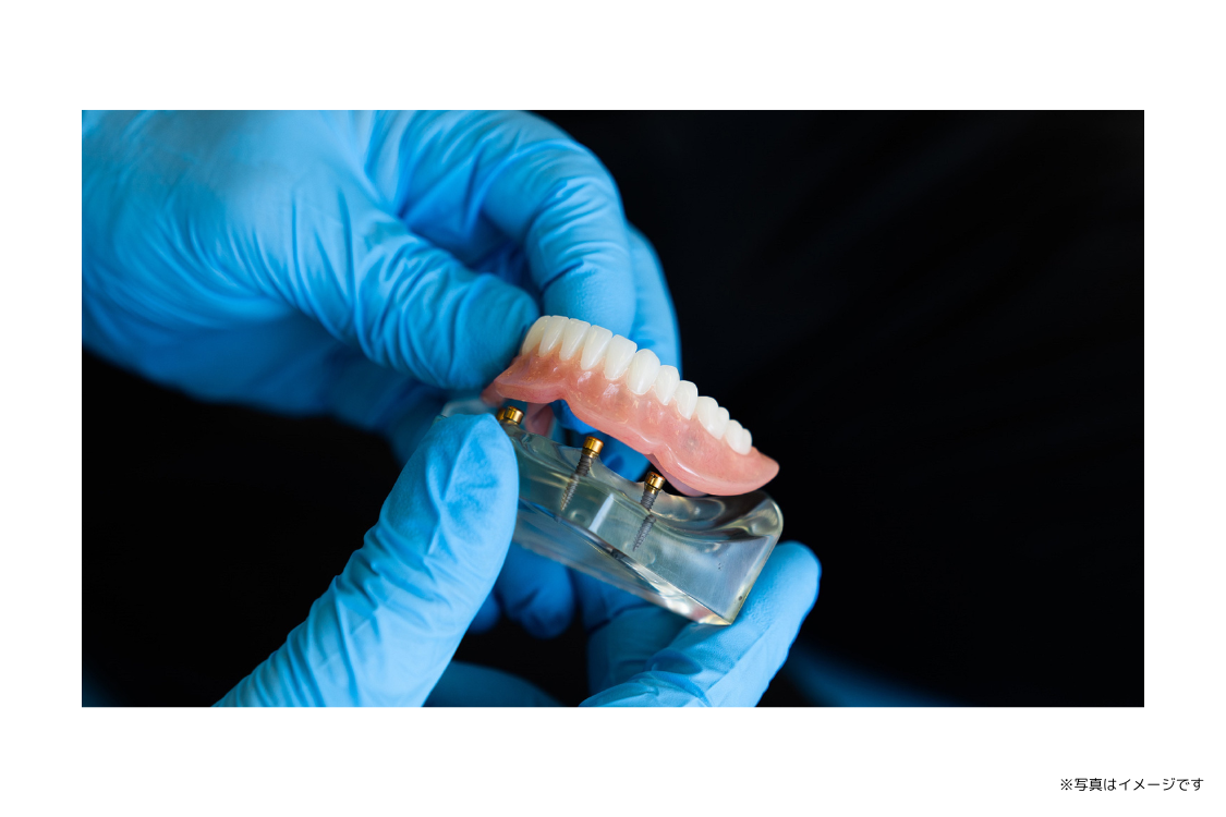 従来の入れ歯の課題を解決する様々な治療選択肢を提供しています
