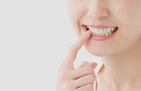 審美歯科治療を提供