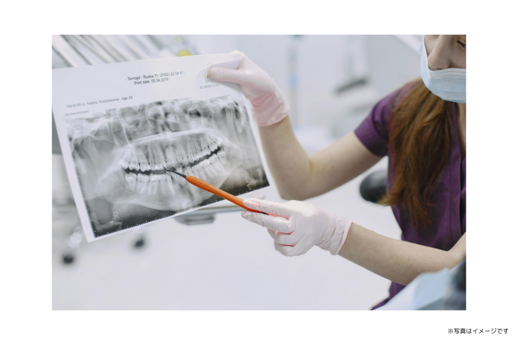 虫歯の早期治療から神経の処置に至るまで、症状の進行に応じた対応を実施しています