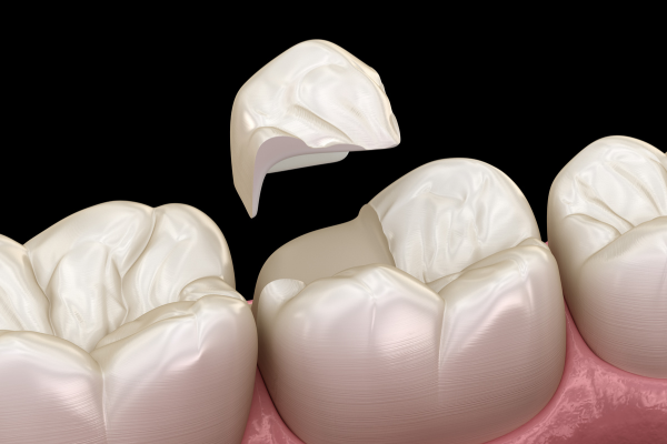 ※画像はイメージです
