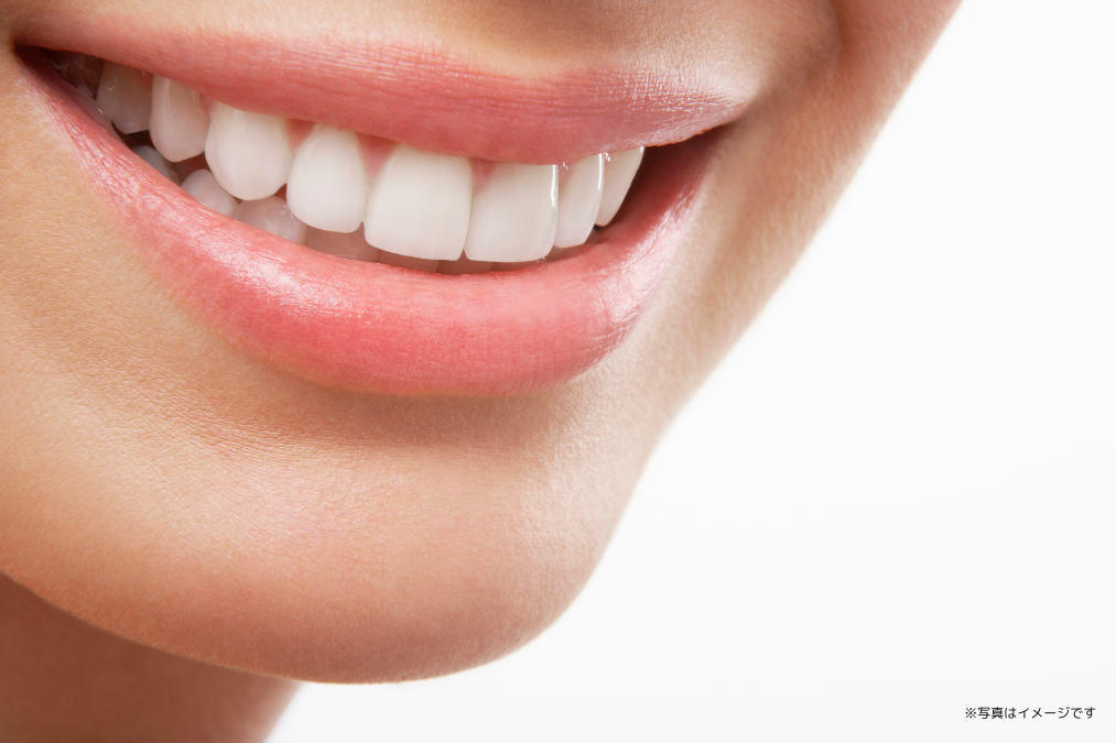 ※写真はイメージです