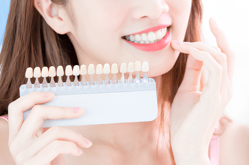 多彩な材料選択により理想的な口元の美しさを実現