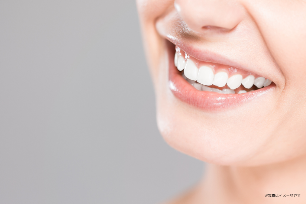 ※画像はイメージです