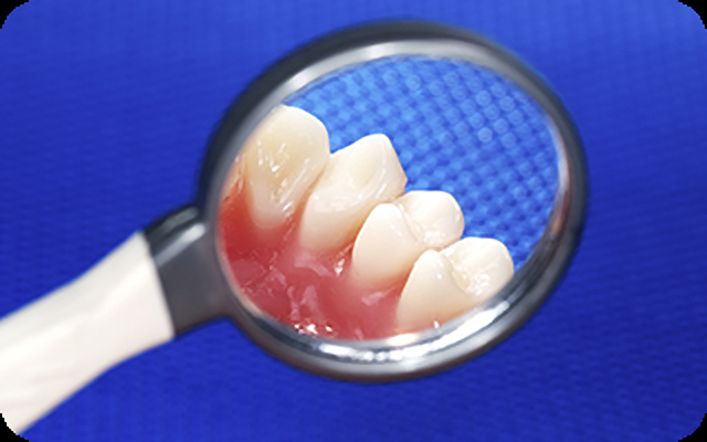 お口に異変を感じたら歯科医院を受診しましょう