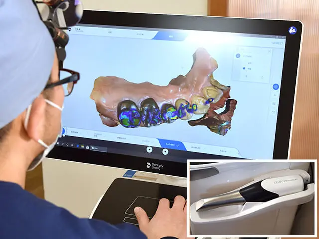 コンピュータ制御によって歯の修復物を設計・製作するCAD/CAM治療を提供しています