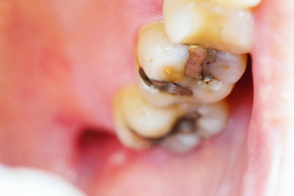 ※画像はイメージです