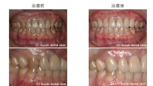 歯の見た目を整えることには多くのメリットがあります