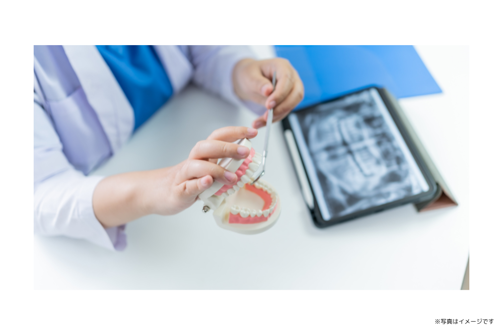 削る範囲を抑えた修復で歯の負担を軽減しています