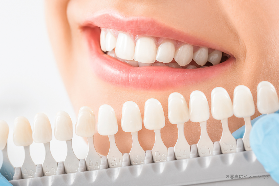 継続的なケアを視野に入れたホワイトニング環境が整えられています