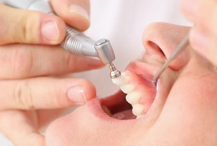 定期的に予防処置をすることで口腔内を清潔に保ち、病気を未然に防ぐことが重要です